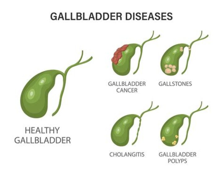 Will endoscopy show gallbladder problems?