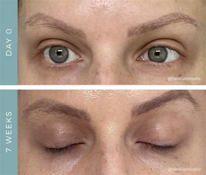 Will eyebrows grow back after chemo?