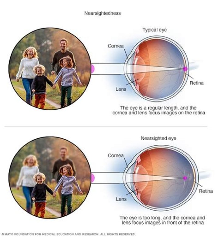 Will my child outgrow farsightedness?