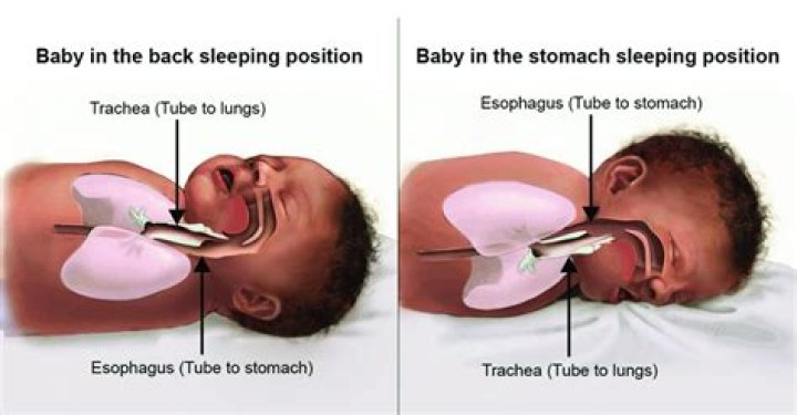 Will sleeping on side hurt baby?