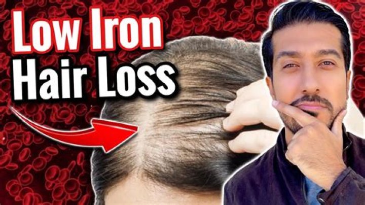 Would low iron cause hair loss?